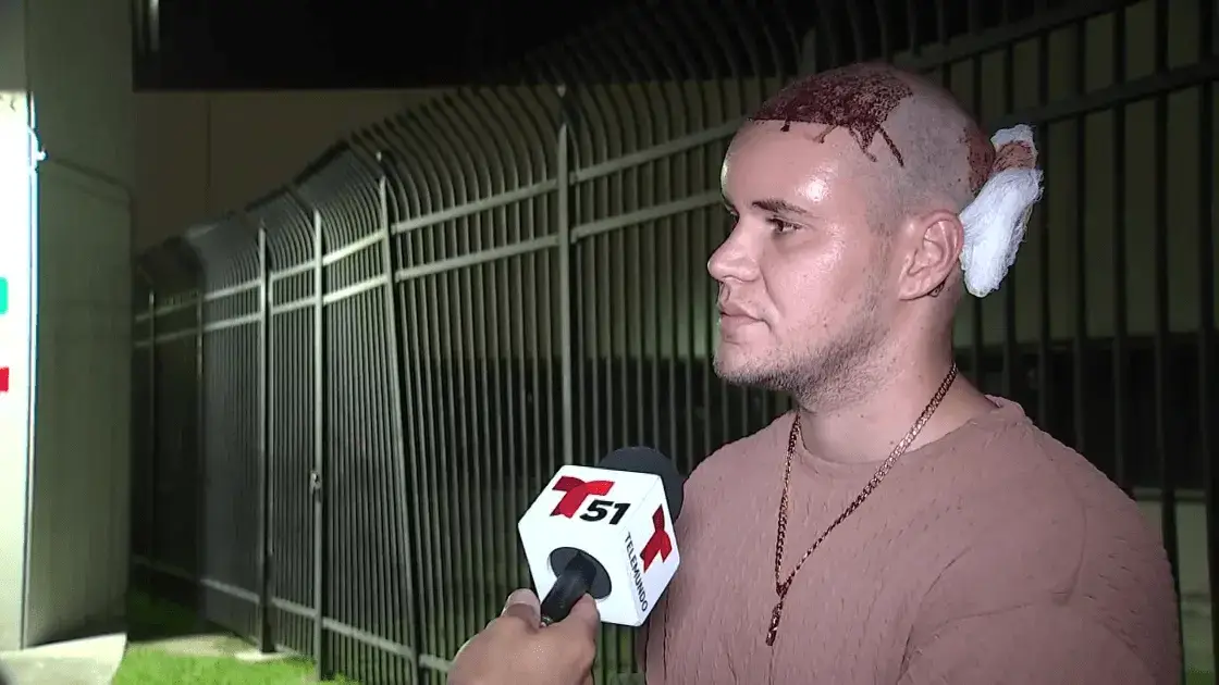 Un homme qui saignait de la tête après une greffe de cheveux a été arrêté avec sa femme après avoir refusé de descendre d’un vol à Miami.